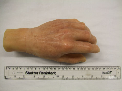 Prosthetic glove
