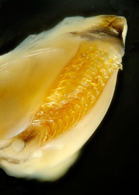 Vermatid radula ('teeth').